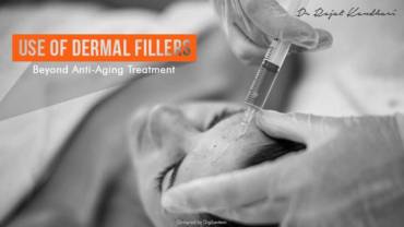 Use of Dermal Fillers : Beyond Anti-Aging Treatment