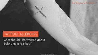 Tattoo Allergies – What should I be worried About Before Getting Inked?
