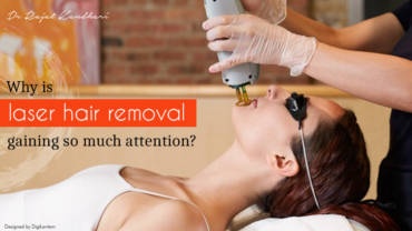 Why Is Laser Hair Removal Gaining So Much Attention?