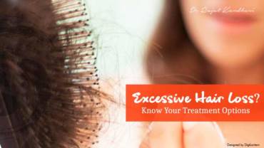 Excessive Hair Loss? Know Your Treatment Options