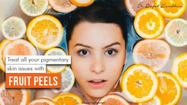 Treat All Your Pigmentary Skin Issues With Fruit Peels