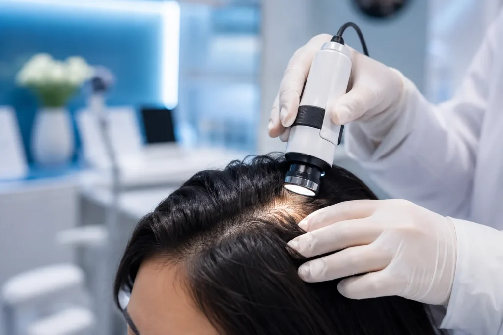 hair PDO threads delhi
